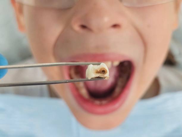 Emergency Dentist Open Today in VA