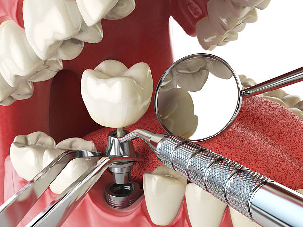 Best Emergency Dental Filling Replacement  in Triangle, VA